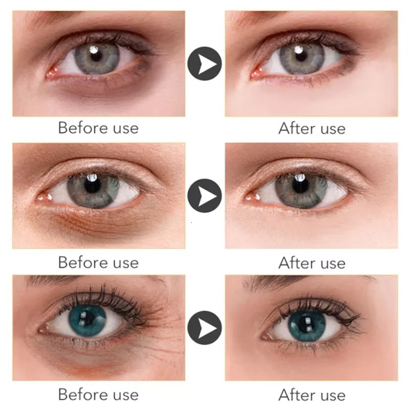 Anti Dark Circle Eye Serum Oil Retinol Anti Firming Skin Eye Bag Fade Fine Line Brighten Eye Care Korea 260318