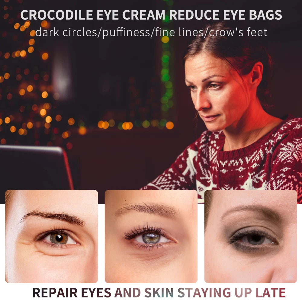 20g Peptide Collagen Eye Essence Cream Anti Anti Dark Circles Eye Bags Eyes Puffy Repair Korean Cosmetics Eye Care 260318