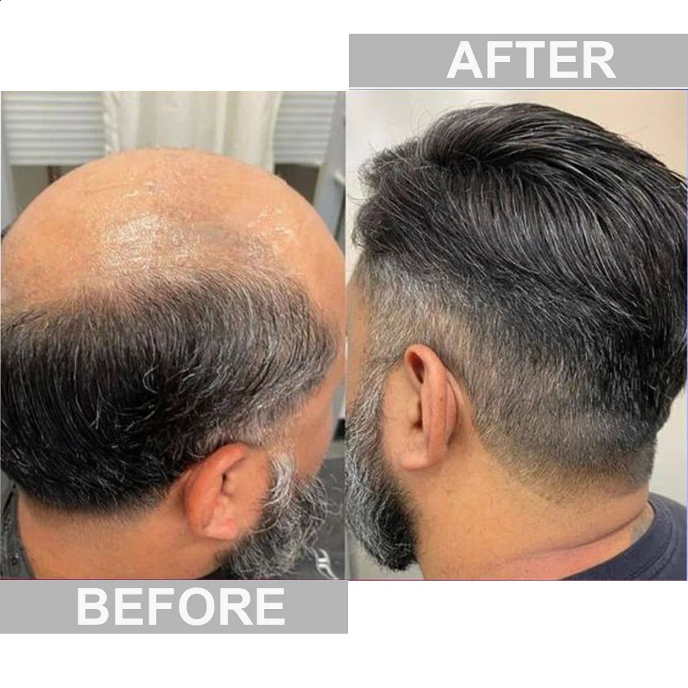Natural Hairline 008 01mm PU Human Prosthesis Wig Full Skin Hairpiece Men Toupee Hair Replacement 260514 - view 6