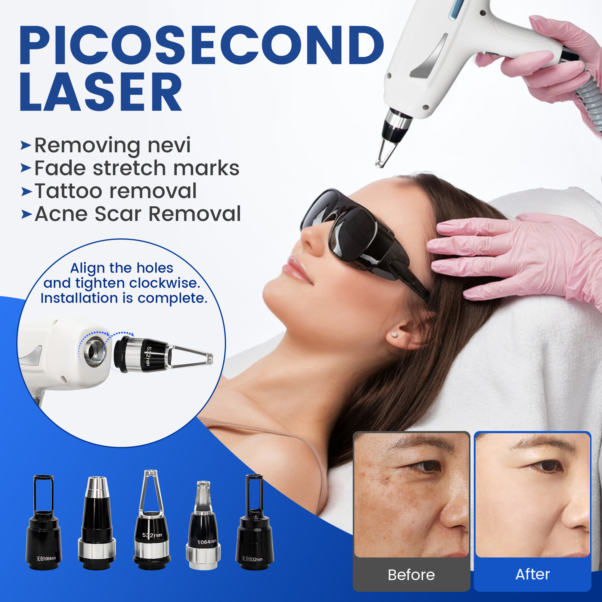 10 Bars Diode Laser Hair Removal with Picosecond Acne Scar Removal Machine 755 808 940 1064nm for Face Arms Legs Bikini