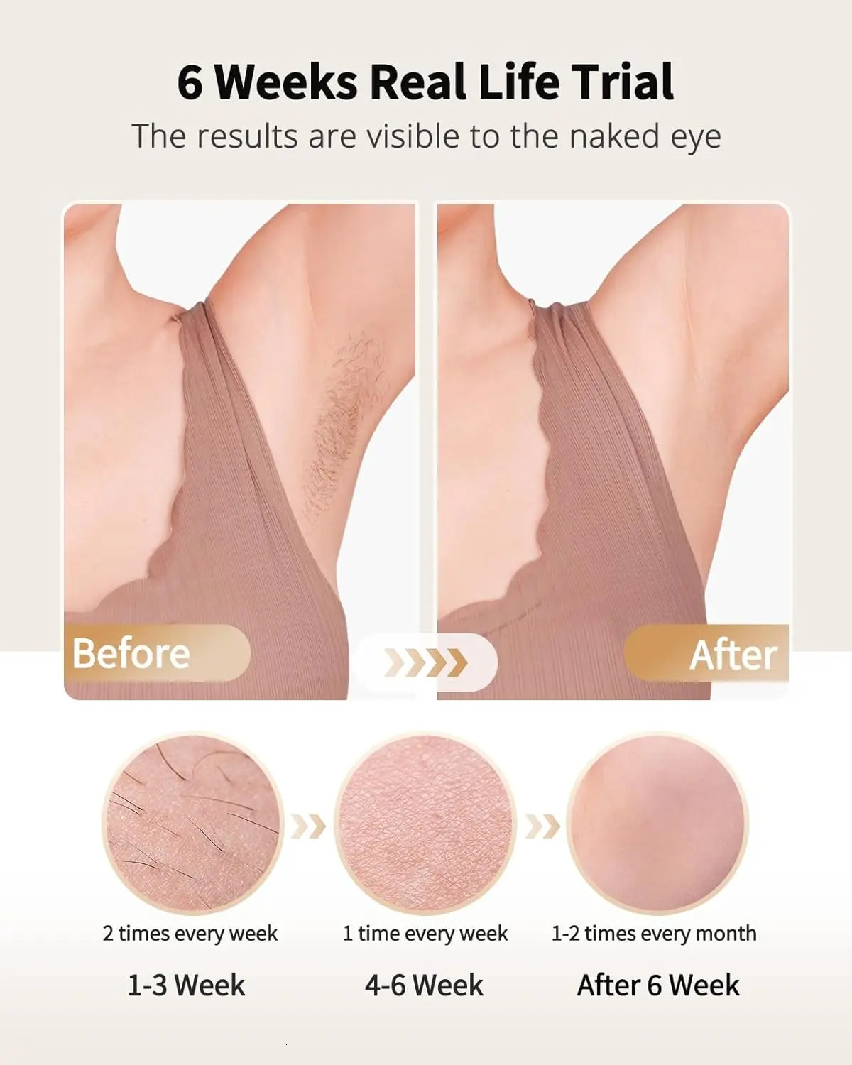 Laser Hair Removal with Ice Cooling Care Function for Women Men PermanentUnlimited Flashes Painless Epilator IPL Hair Remover 260413