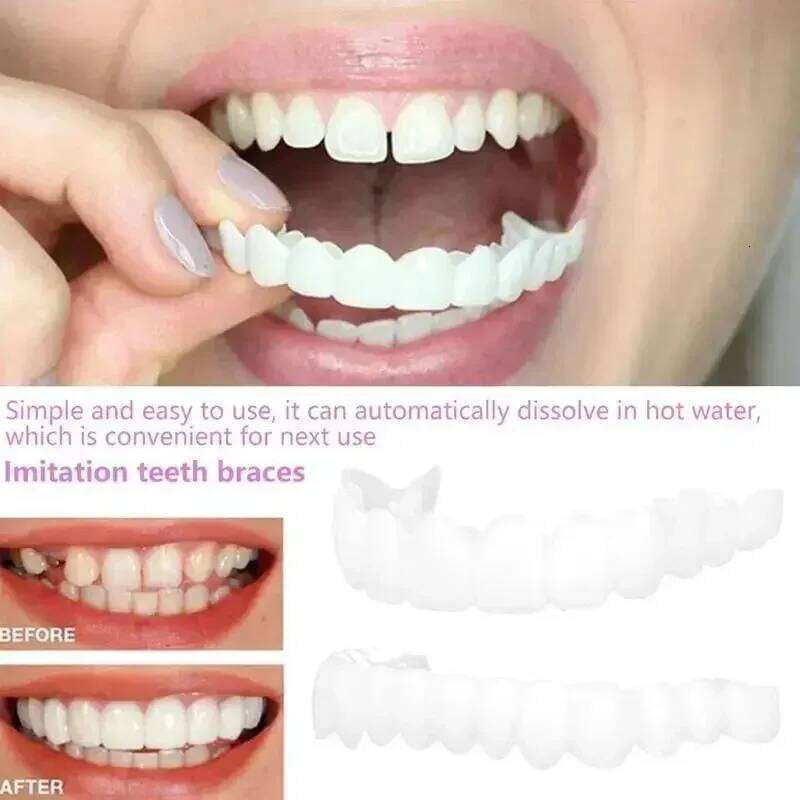 Snap-On Dentures Set, White Plastic Resin Fake Teeth Braces Cosmetic Teeth Replacement - view 7