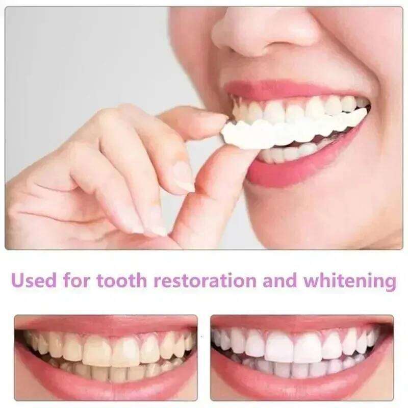Snap-On Dentures Set, White Plastic Resin Fake Teeth Braces Cosmetic Teeth Replacement - view 5
