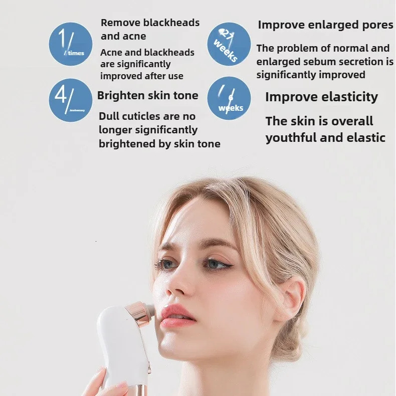 Blackhead Remover Pore Vacuum Face Cleaner Electric Pimple Black Head Removal USB Rechargeable Water Cycle Black Dot Remove 260424