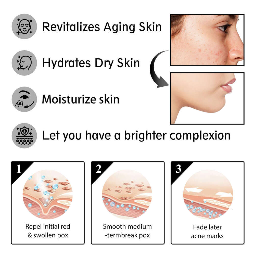 OUHOE Snail Face Cream Gentle Nourishing Hydrating Firming Facial Skin Moisturizing Care Essence S260131