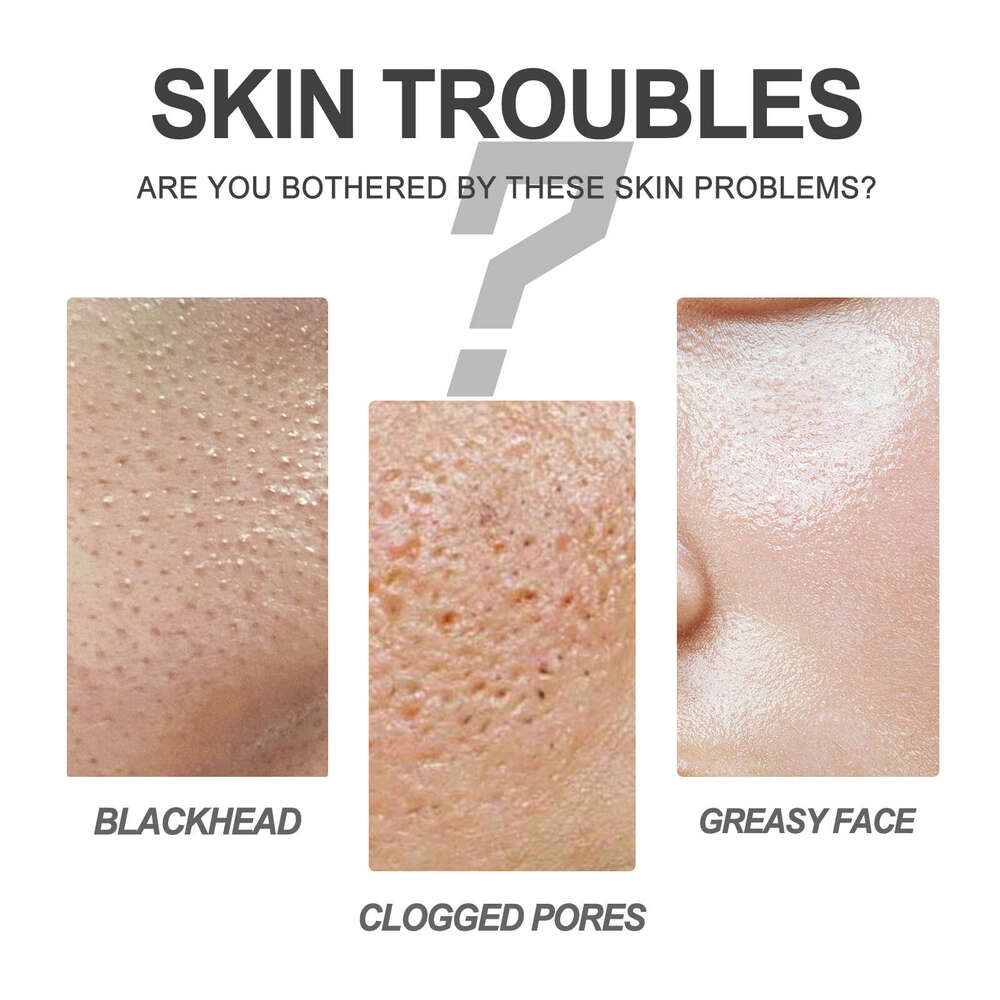 EELHOE Cream Skin Oil Blackhead Acne Pore Cleansing Repair Nose Strips S260131