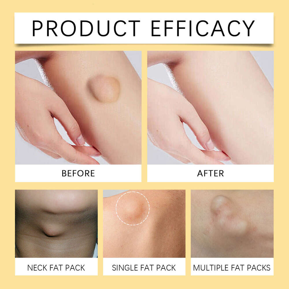 South Moon Bee Venom Gentle Nourishing Skin Smoothing Body Care Cream S260131