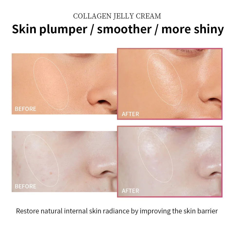 Collagen Jelly Cream Niacinamide Collagen Soothing Aging Firmness Hydration Skincare 260114ww