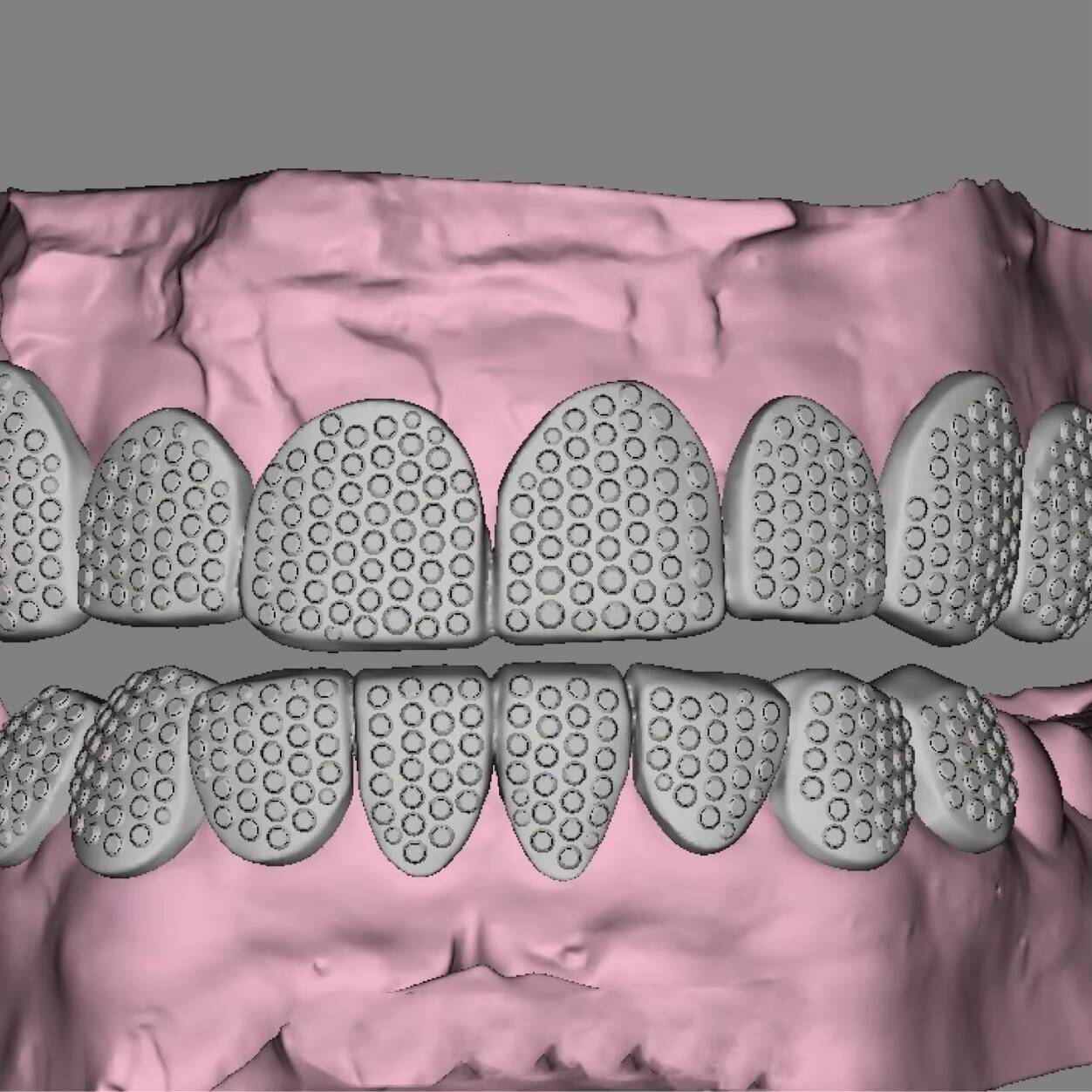 Customized 16 Teeth Iced Grillz 14kt White Gold 925 Silver D VVS Moissanite Fine Piercing Jewelry for Men Women for Weddings