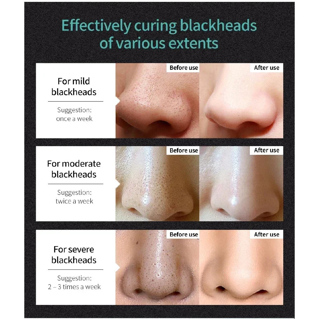 LANBENA Blackhead Mask Pore Deep Cleaning Mask Improve Rough Skin- Brighteing Skin Care 260130
