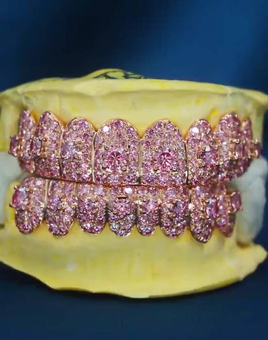 Queensun Custom Fine Rose Yellow Rose Moissanite Teeth Jewelry DEF VVS Iced Grillz 925 Silver Luxury Moissanite Jewelry