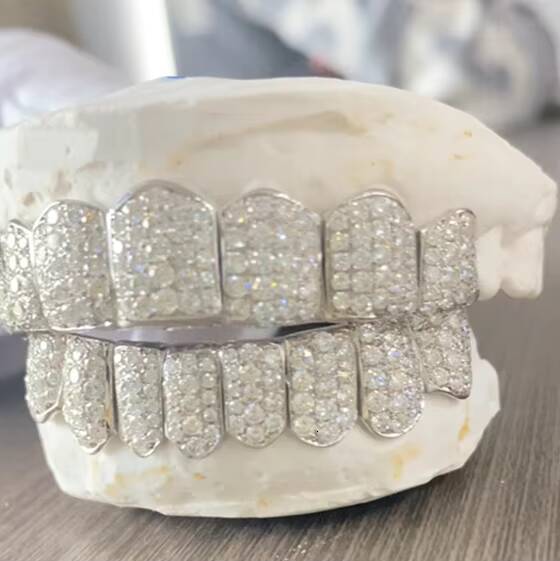 Hip Hop Jewelry Free Dental Mold Custom 925 Sterling Silver Iced Out VVS Moissanite Diamond Perm Cut Grillz 8 on 8 for Teeth