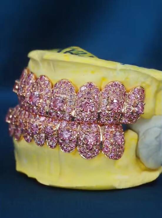 Queensun Custom Fine Rose Yellow Rose Moissanite Teeth Jewelry DEF VVS Iced Grillz 925 Silver Luxury Moissanite Jewelry