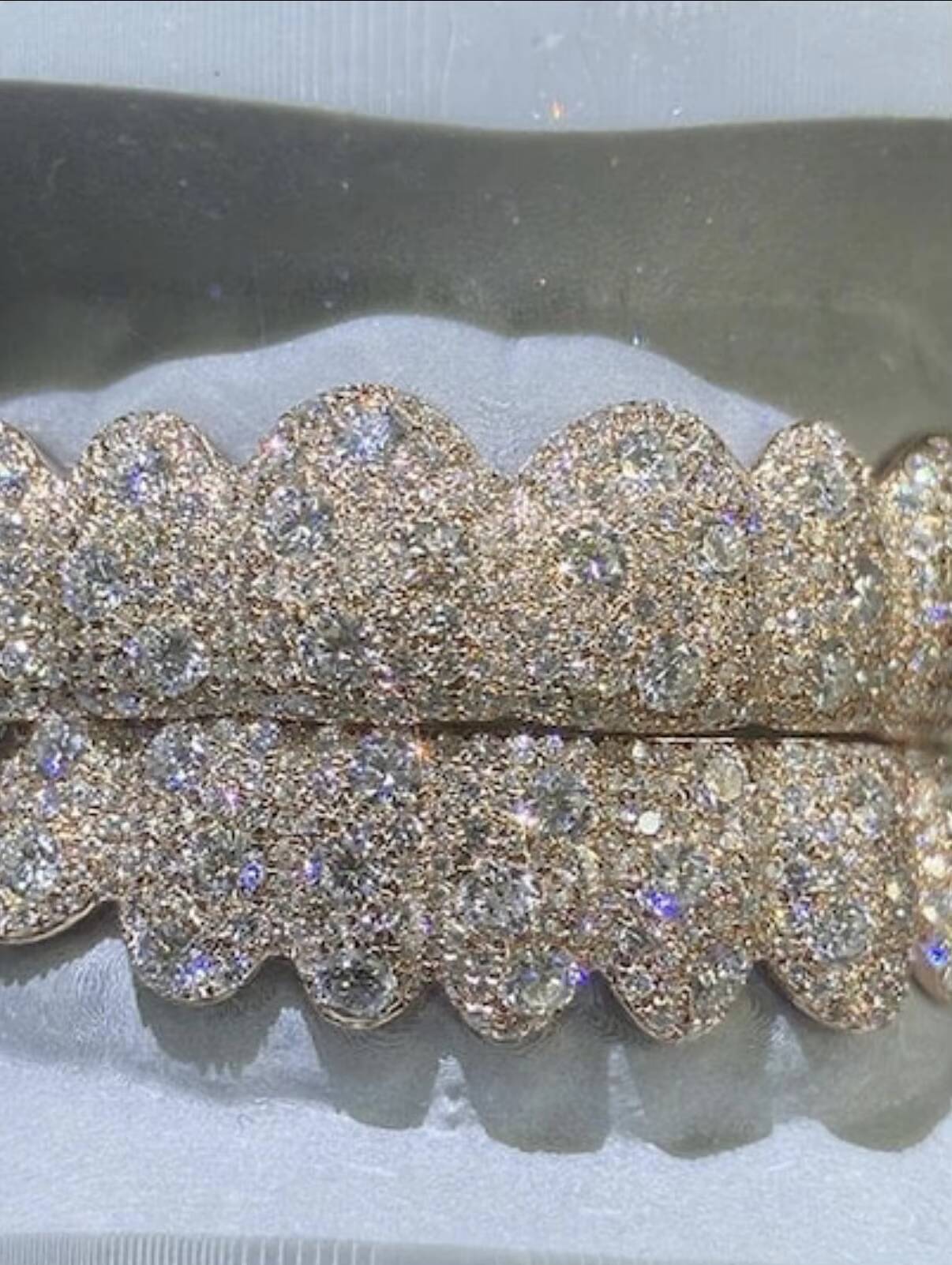 Luxurious Rose Gold Moissanite Diamond Grillz Set Custom Teeth Jewelry High Clarity Stones for Lasting Shine