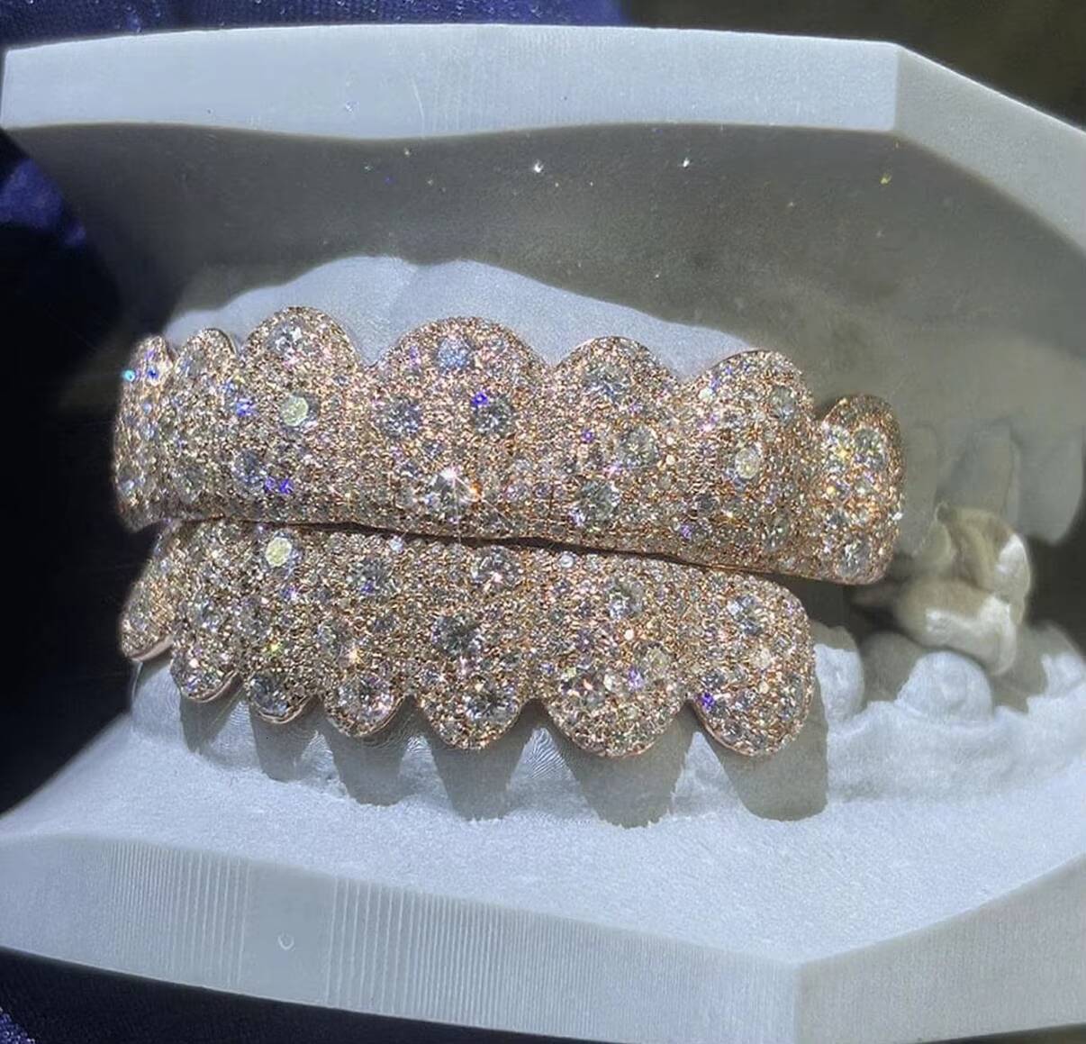 Luxurious Rose Gold Moissanite Diamond Grillz Set Custom Teeth Jewelry High Clarity Stones for Lasting Shine