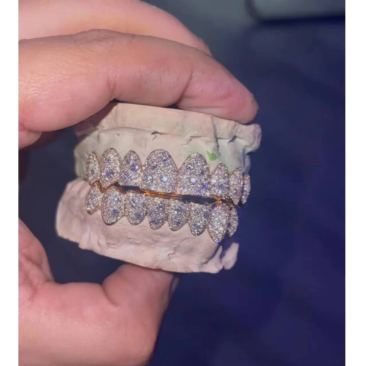 Custom Fit Lab Grown Moissanite Grillz for Teeth Fashion Jewelry Rhodium Plated 925 Sterling Silver High Shine Finish India