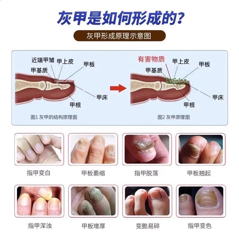 Nail Sander Set Electric Nail Drill Machine Grinding Equipment Milling Cutter For Manicure Pedicure Strong Polishing Tools 250807