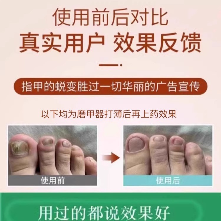 Nail Sander Set Electric Nail Drill Machine Grinding Equipment Milling Cutter For Manicure Pedicure Strong Polishing Tools 250807