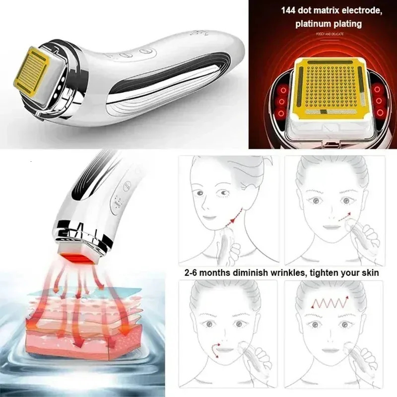 Electric Machine Dot Matrix Skin Rejuvenation Removal Face Massager Home Use Beauty Devices 260618BJ - view 5