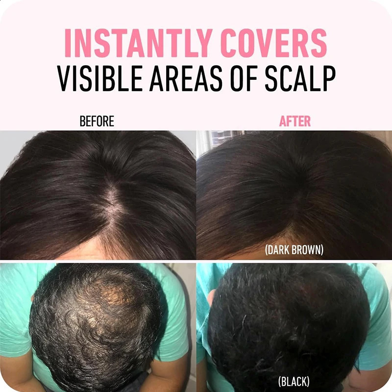 Hairline Shadow PowderInstantly Conceal Hairline And Hair Root Waterproof Hairline Powder FillerHair Root CoverScalp Powder 260626 - view 3