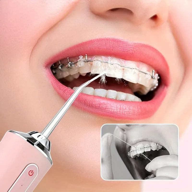 USB Portable Oral Irrigator Water Flosser Dental Jet Tools Pick Cleaning Teeth 200ML 4 Nozzles Mouth Agents 260626 - view 5
