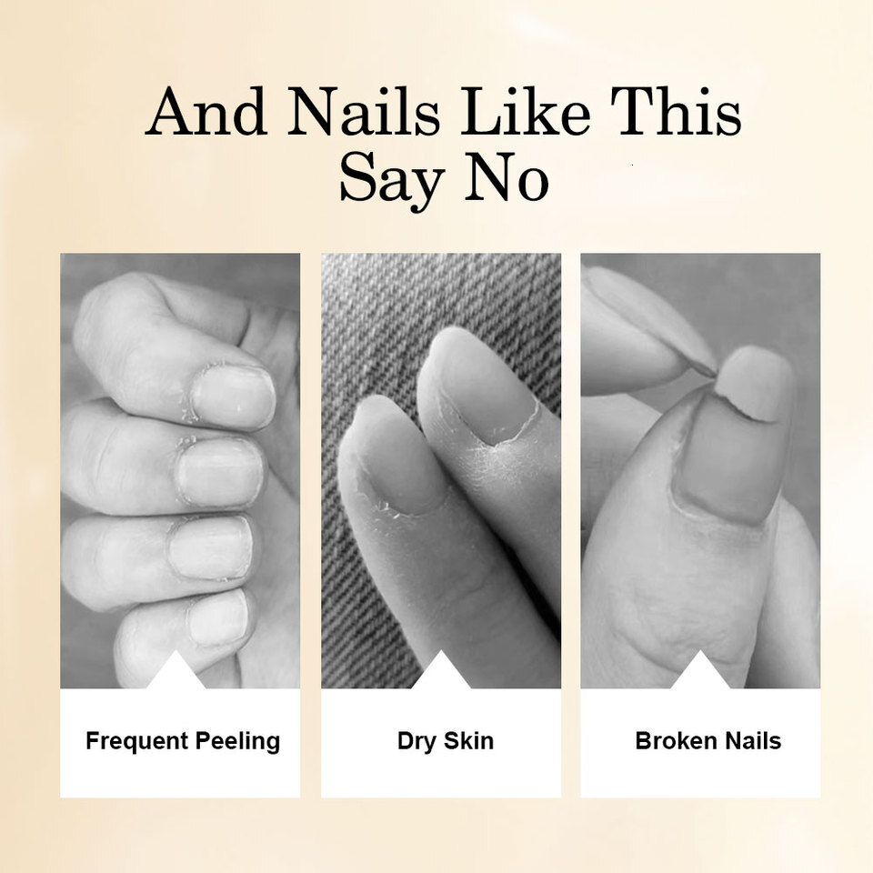 Luxury 2026 New 15ml Cuticle Nutrient Oil Nourishes Repairs Damaged Nails Moisturizing Strengthens And Brightens Care Nail Treatments Fast Shipping X2 - view 4