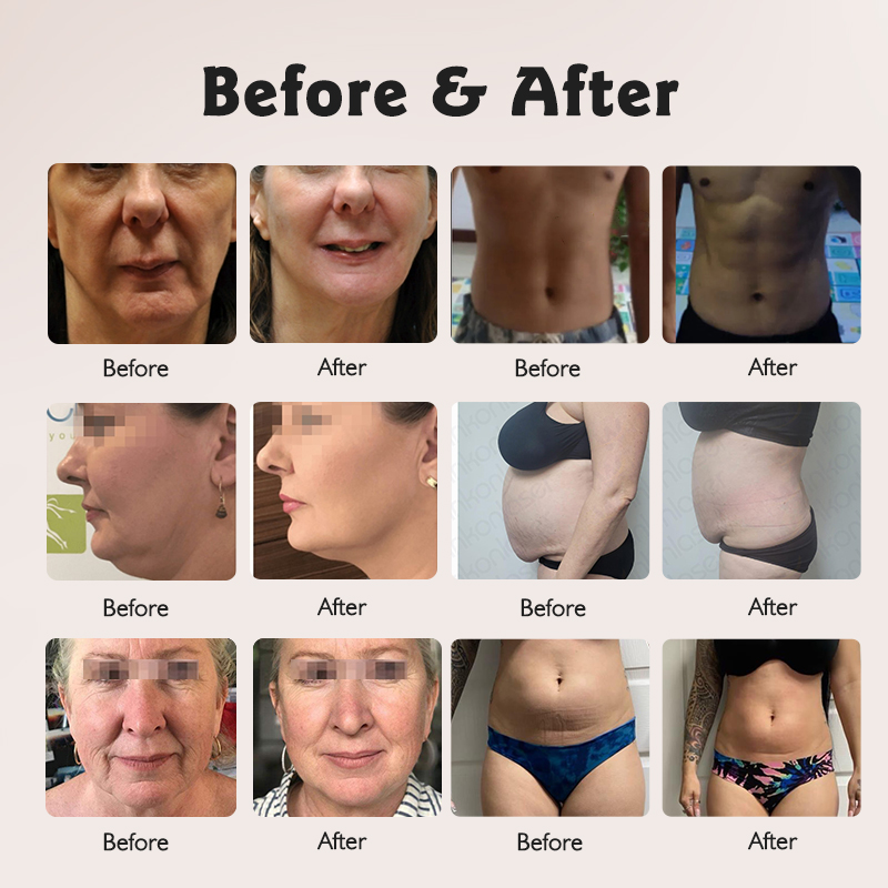 EMS weight loss machine HIEMT Sculpt body slimming EMT wrinkle removal anti-aging beauty equipment detailed user manual