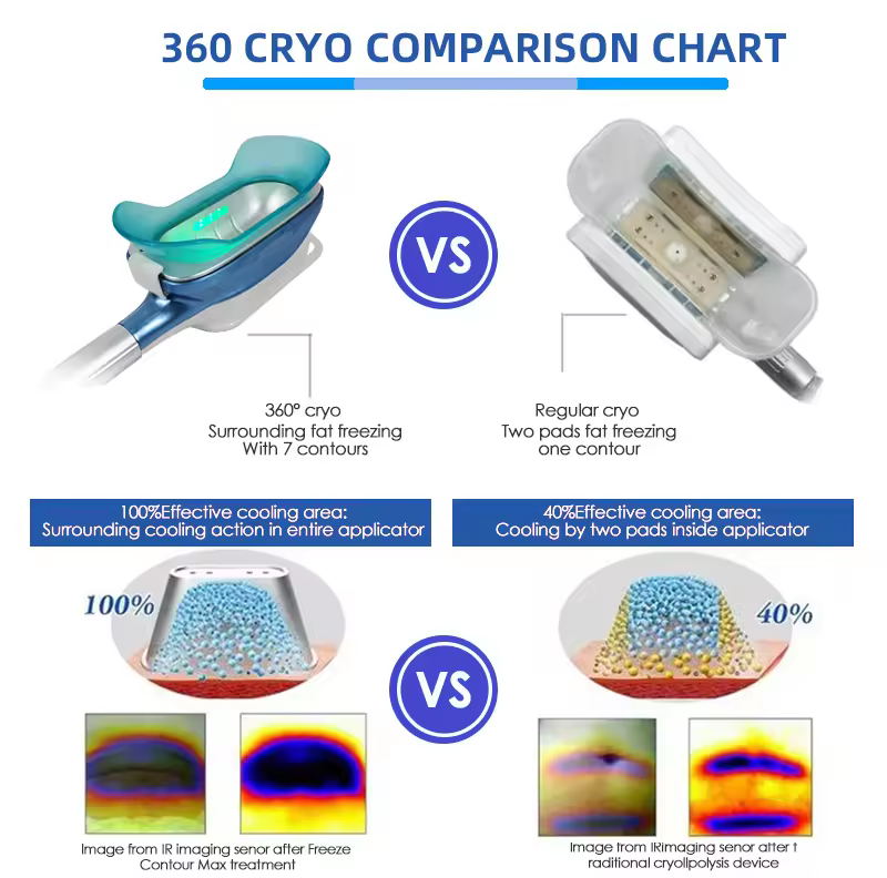 360 Fat Freezing Machine Cryolipolysis Slimming Machine Crio Kryo Criolipolisis Kryolipolyse Cryolipolisis Cryo Slimming Machine