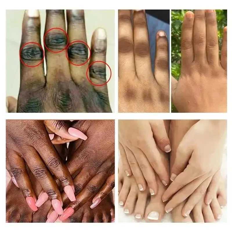 Kojic Acid Fade Dull Hand Cream Body Fast Smooth Nourish Cream Lightening Black Skin Brightening Moisturizing Korean Skin Care M240906