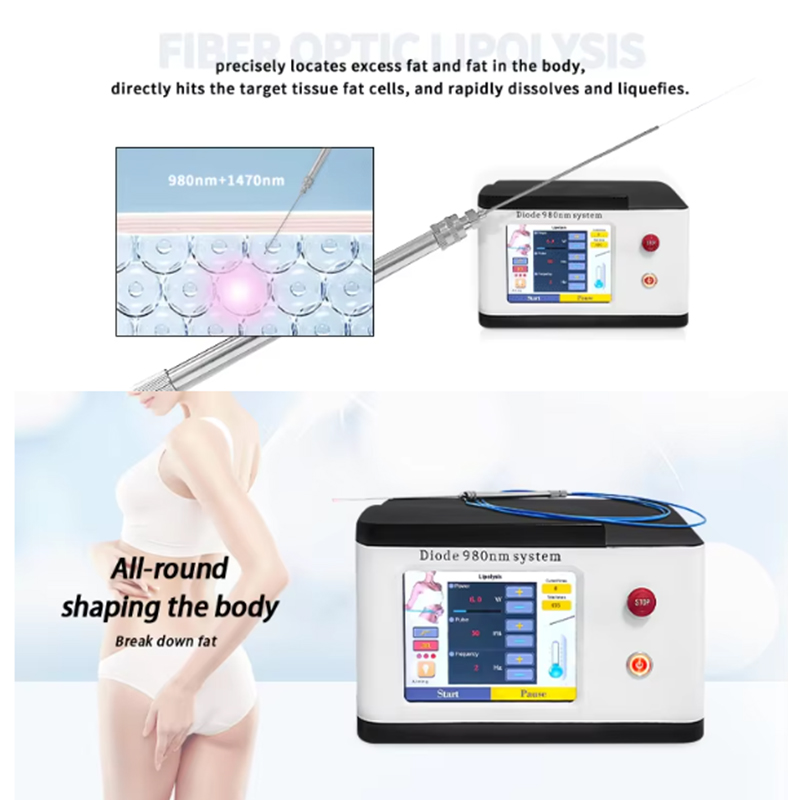 High Quality 980Nm Laser Plastic Liposuction Surgery Laser Fiber For Lipolysis Fat Reduction Diode Laser Endolift Liposuction Machine