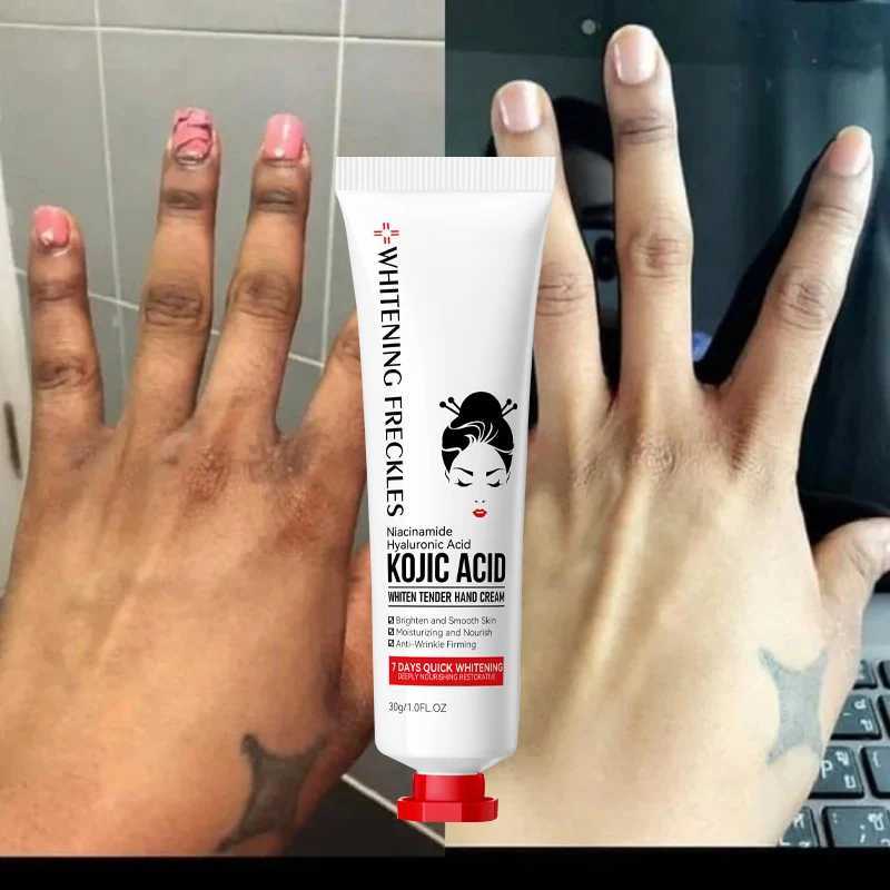 Kojic Acid Fade Dull Hand Cream Body Fast Smooth Nourish Cream Lightening Black Skin Brightening Moisturizing Korean Skin Care M240906