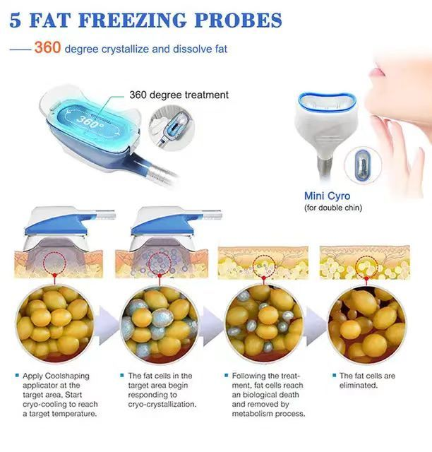 360 Degree Cryolipolysis 9 Handles Cryo Cryotherapy Fat Freezing Criolipolisis Machine cryolipolysis device price weight loss