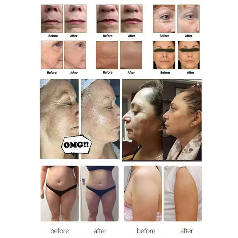 Portable Ultrasound 3 in 1 Anti-aging Machine Face Lifting Skin Rejuvenation Body Contour Reshaping Ultrasonic Device HIFU Face Lifting Wrinkle Reduct