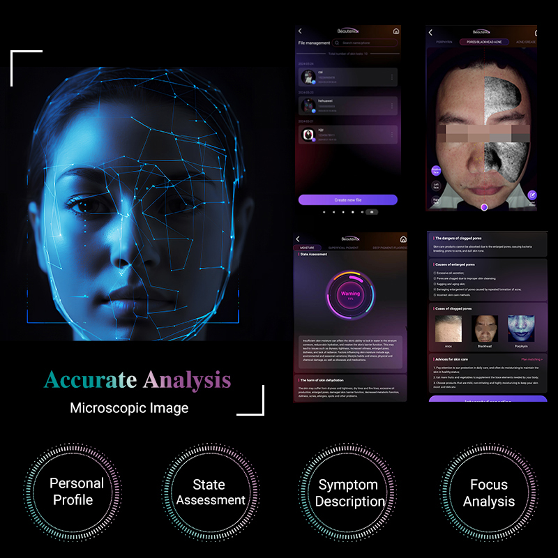 2025 AI Skin analysis machine Analyze 15 skin problems magic mirror solve acne pigmentation marks Skin Wrinkle removal