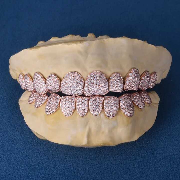 Top Quality 14k Rose Gold Diamond Grillz Customized VVS Moissanite Diamond Teeth Grillz Hip Hop Iced out Grillz For Men