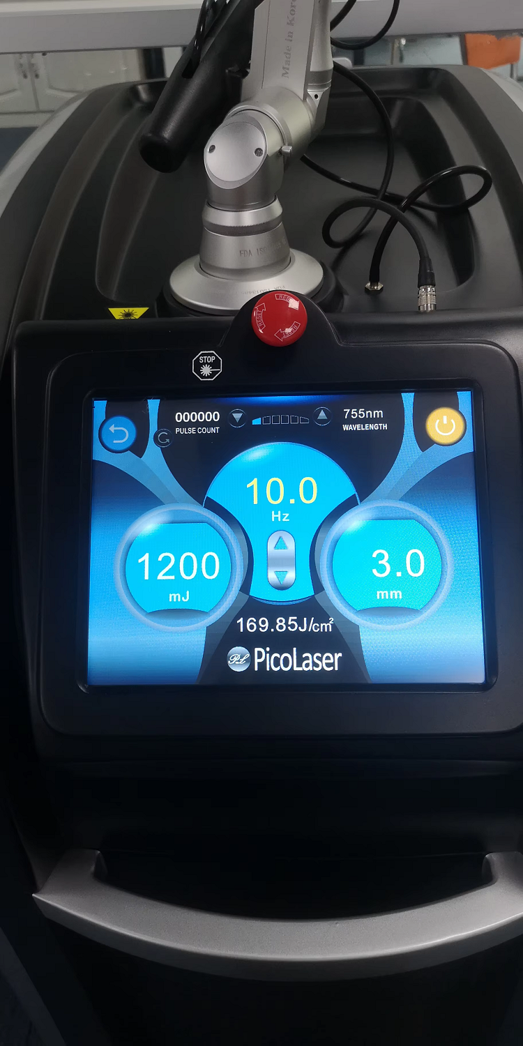 Stationary 1064 532 755 Pico Laser Tattoo Removal Yag Picosecond Laser Machine For Pigment Removal