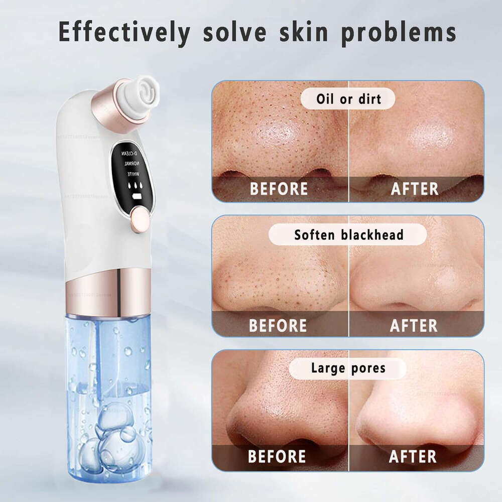 Blackhead Remover Pore Vacuum Face Cleaner Electric Pimple Acne Head Removal USB Rechargeable Water Cycle Black Dot Remove