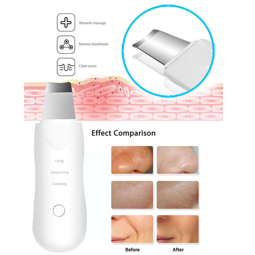 Ultrasonic Skin Deep Vibrate Cleaner Shovel Face Scrubber Peeg Black Head Remover Facial Massager