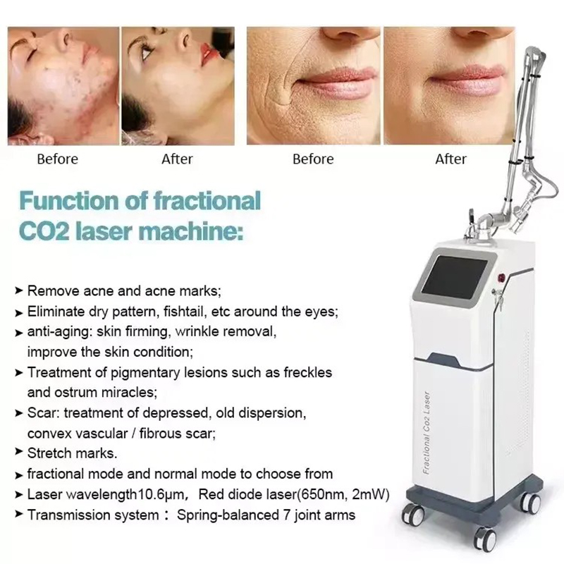 Vertical Fractional Co2 Laser Device Co2 Fractional Tightening Laser Acne Scar Removal Machine For Clinic