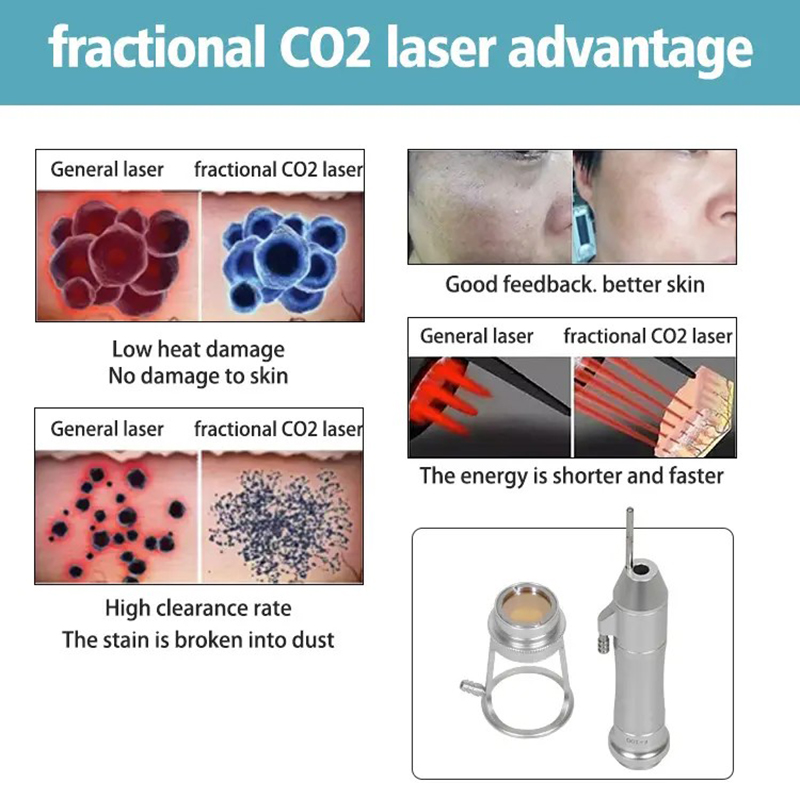 Vertical Fractional Co2 Laser Device Co2 Fractional Tightening Laser Acne Scar Removal Machine For Clinic
