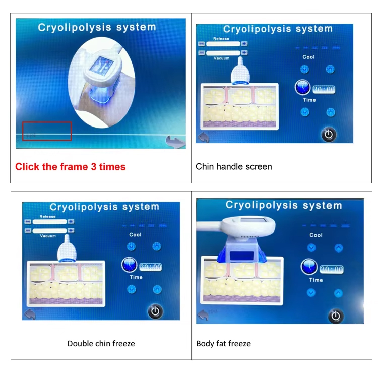 New New Model 360 Cryo Body Slimming Cryo Lipolysis Fat Freezing Cellulite Reduction Double Chin Removal Machine Pain-Free Cryolipolysis Body Sli