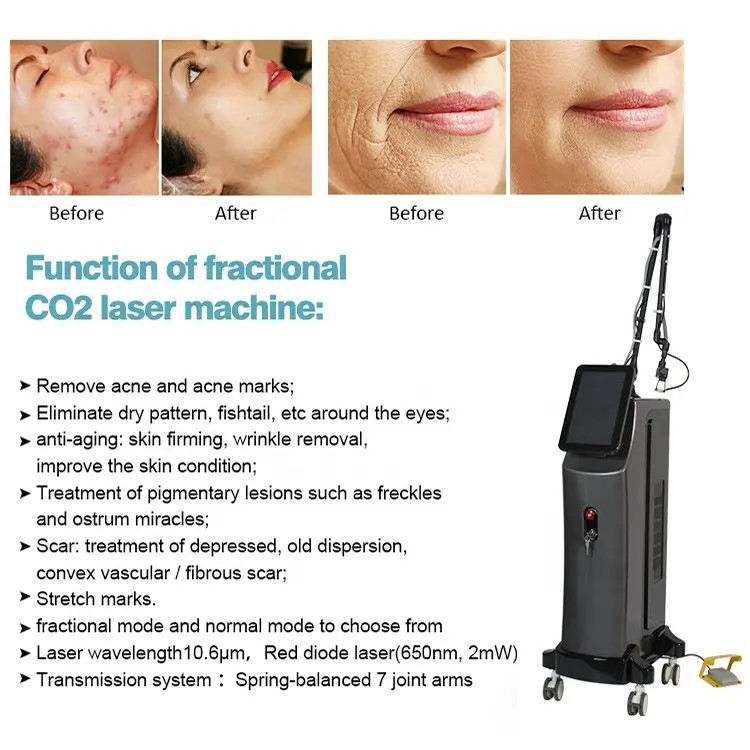 Newest CO2 Fractional Laser Stretch Mark Wrinkle Removal CO2 Fractional Laser Scar Treatment Machine