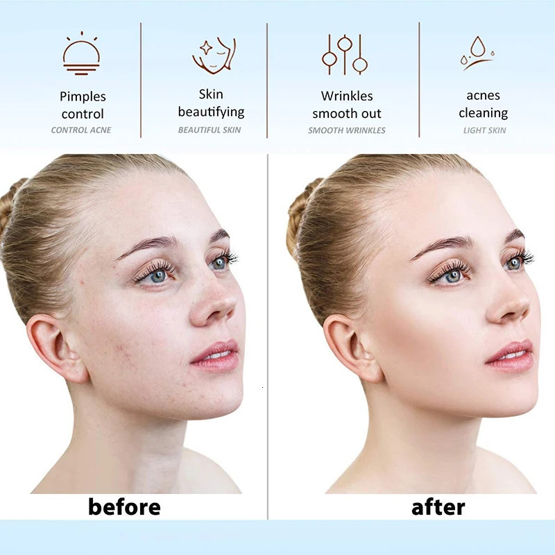 High Frequency Machine Skin Therapy Electrode Wand Neon Electrotherapy Glass Tube Acne Spot Remover Face Skin Care Device 240103