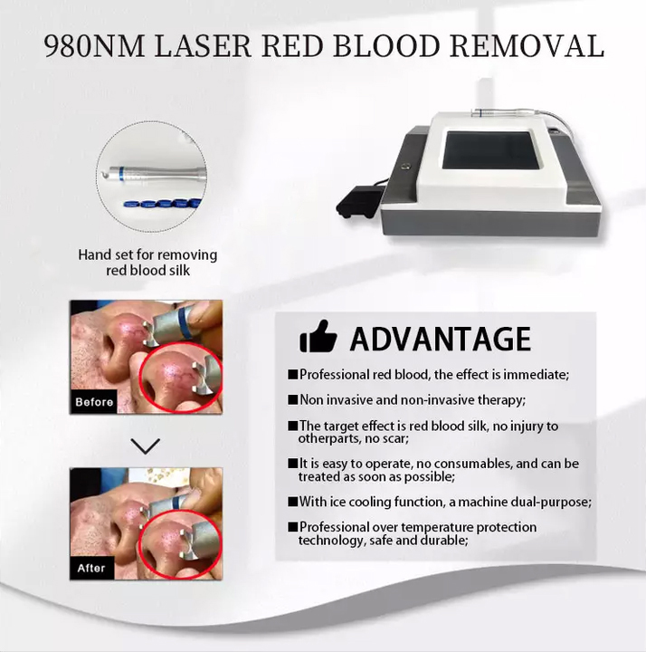 Professional Painless Vascular Therapy 980Nm Diode Laser Red Blook Silk Spider Vein Remove Treatment For Pigment Lesion Broken Vein