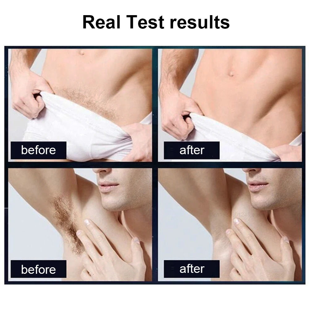 Body Trimmer For Men Painless Epilator Rechargeable Shaver For Sensitive Areas Bikini IPX7 Electirc Epilator Body Hair Trimmer 240112