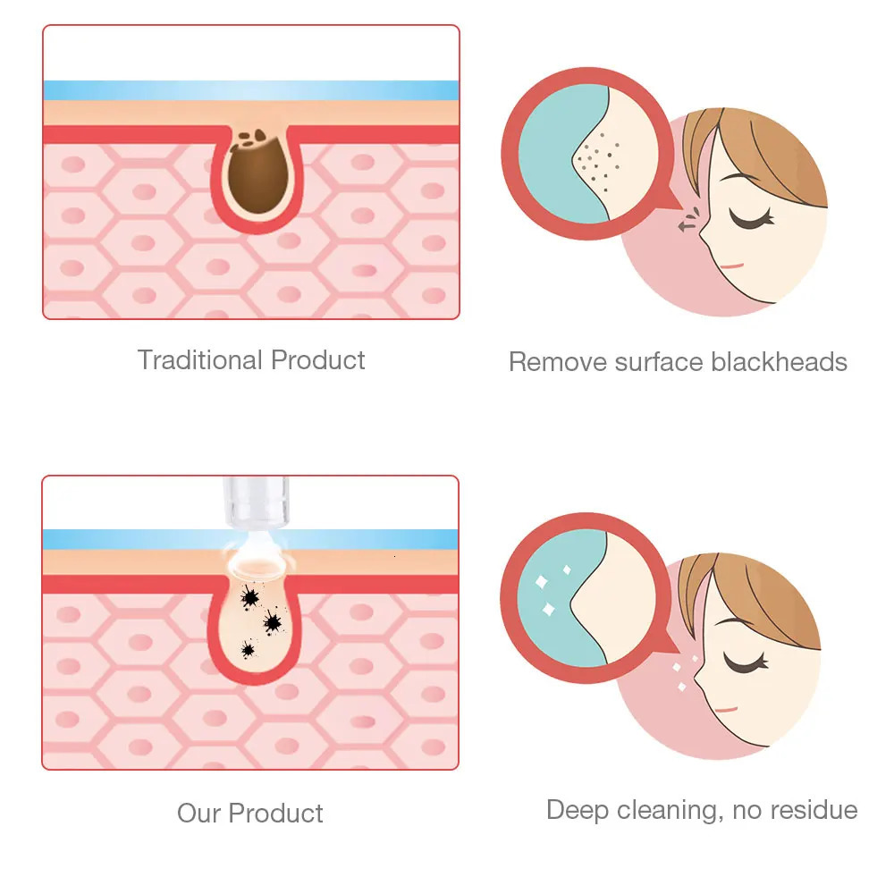 Digital Diamond Microdermabrasion Vacuum Blackhead Cleaner Acne Marks Removal Machine Deep Cleaning Pores Skin Care Tool 240112