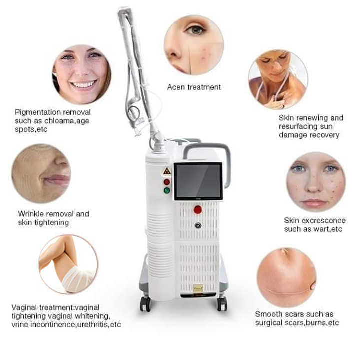 2024 Fotona 4D 10600nm Fractional CO2 Laser machine co2 fractional laser Factory wholesale price