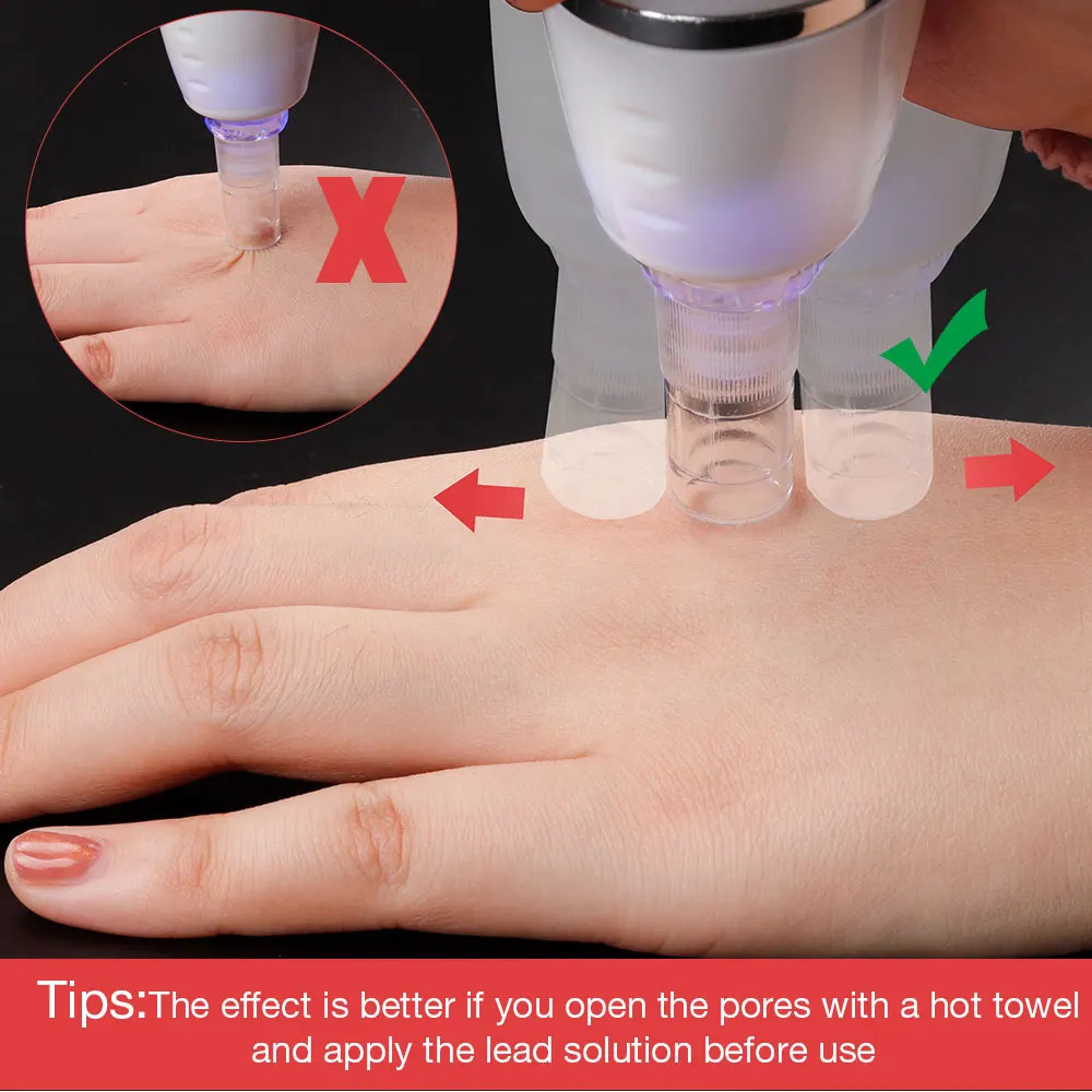 Digital Diamond Microdermabrasion Vacuum Blackhead Cleaner Acne Marks Removal Machine Deep Cleaning Pores Skin Care Tool 240112