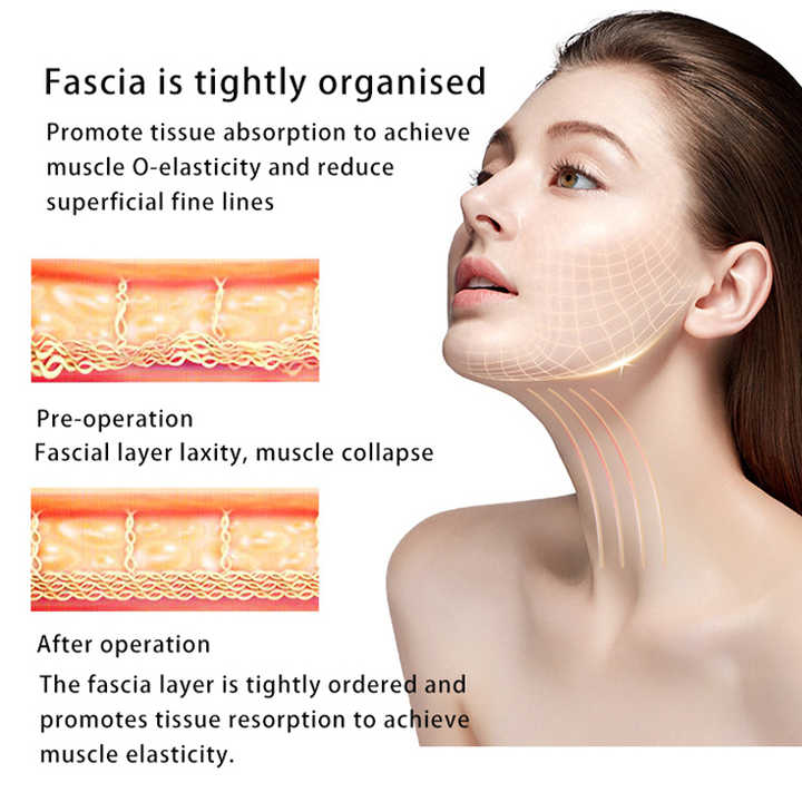 448KHZ Fever Master Cet Ret Rf Tecar Diathermy Physiotherapy Facial Lifting Body Sculpting EMS Muscle Scraper Weight Loss Device