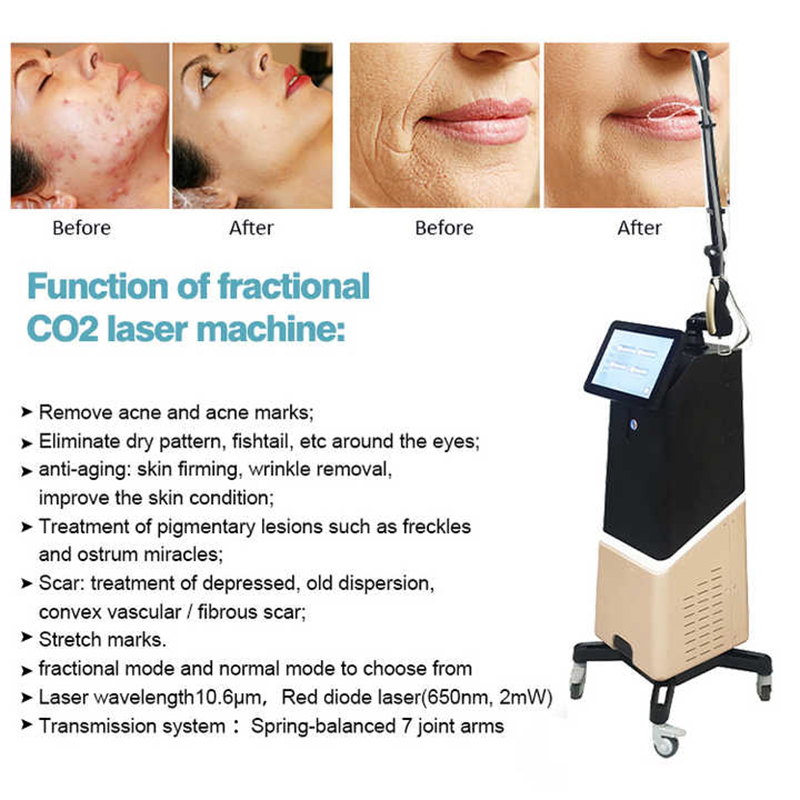 Co2 Fractional 60W Skin Resurfacing Scar Removal Dermatology Laser Acne Treatment Machine